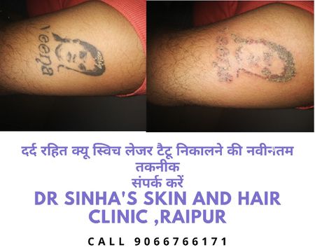 Dr sinha's skin & hair clinic - Official
